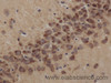 Immunohistochemistry of paraffin-embedded Rat brain using TSHB Polyclonal Antibody at dilution of 1:50