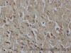 Immunohistochemistry of paraffin-embedded Mouse brain using LUM Polyclonal Antibody at dilution of 1:50