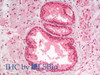 Immunohistochemistry analysis of paraffin-embedded Human Prostate using AKT1 Polyclonal Antibody(Elabscience® Product Detected by Lifespan).