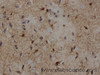 Immunohistochemistry of paraffin-embedded Rat brain using S100B Polyclonal Antibody at dilution of 1:50