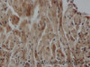 Immunohistochemistry of paraffin-embedded Rat heart using ARF6 Polyclonal Antibody at dilution of 1:50