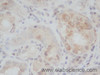 Immunohistochemistry of paraffin-embedded Rat kidney using ERG Polyclonal Antibody at dilution of 1:50