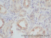 Immunohistochemistry of paraffin-embedded Rat kidney using Smad3 Polyclonal Antibody at dilution of 1:50