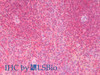 Immunohistochemistry analysis of paraffin-embedded Human Spleen using CD70 Polyclonal Antibody(Elabscience® Product Detected by Lifespan).