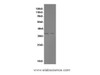 Western Blot analysis of HepG-2 and K562 cells using MyD88 Polyclonal Antibody at dilution of 1:600