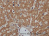 Immunohistochemistry of paraffin-embedded Mouse liver using CK-20 Polyclonal Antibody at dilution of 1:50