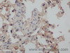 Immunohistochemistry of paraffin-embedded Rat lung using CAMP Polyclonal Antibody at dilution of 1:50