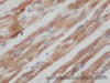 Immunohistochemistry of paraffin-embedded Mouse heart using UQCRFS1 Polyclonal Antibody at dilution of 1:50