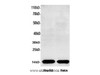 Western Blot analysis of HepG2 and HeLa cells using COX5B Polyclonal Antibody at dilution of 1:600