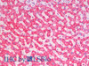 Immunohistochemistry analysis of paraffin-embedded Human Liver using SDHA Polyclonal Antibody(Elabscience® Product Detected by Lifespan).