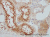 Immunohistochemistry of paraffin-embedded Mouse kidney using CST5 Polyclonal Antibody at dilution of 1:50