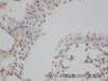 Immunohistochemistry of paraffin-embedded Mouse lung using EEF1E1 Polyclonal Antibody at dilution of 1:50