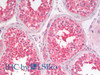 Immunohistochemistry analysis of paraffin-embedded Human Testis using EEF1E1 Polyclonal Antibody(Elabscience® Product Detected by Lifespan).