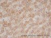 Immunohistochemistry of paraffin-embedded Rat liver using EEF1E1 Polyclonal Antibody at dilution of 1:50
