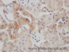 Immunohistochemistry of paraffin-embedded Rat kidney using ALPL Polyclonal Antibody at dilution of 1:50