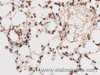 Immunohistochemistry of paraffin-embedded Rat lung using STK4 Polyclonal Antibody at dilution of 1:50