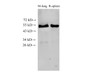 Western Blot analysis of Mouse lung and Rat spleen tissue using ILK Polyclonal Antibody at dilution of 1:1000