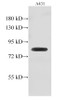 Western Blot analysis of A431 cell using GUSB Polyclonal Antibody at dilution of 1:500