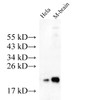 Western Blot analysis of Hela cells and Mouse brain tissue using KRAS Polyclonal Antibody at dilution of 1:500