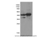 Western Blot analysis of Rat heart and Mouse heart tissue using TNNT2 Polyclonal Antibody at dilution of 1:600