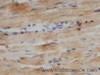 Immunohistochemistry of paraffin-embedded Mouse heart using TNNT2 Polyclonal Antibody at dilution of 1:50