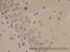 Immunohistochemistry of paraffin-embedded Rat brain using SOX-2 Polyclonal Antibody at dilution of 1:50