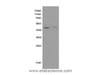 Western Blot analysis of Hela and Raji cells using FAS Polyclonal Antibody at dilution of 1:600