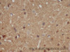 Immunohistochemistry of paraffin-embedded Mouse brain using AB42 Polyclonal Antibody at dilution of 1:50