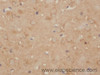 Immunohistochemistry of paraffin-embedded Rat brain using CD86 Polyclonal Antibody at dilution of 1:50