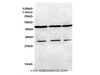 Western Blot analysis of HeLa, 293Tand Jurkat cells using ASCC1 Polyclonal Antibody at dilution of 1:600