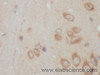 Immunohistochemistry of paraffin-embedded Mouse brain using ACSBG1 Polyclonal Antibody at dilution of 1:50