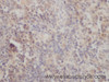 Immunohistochemistry of paraffin-embedded Mouse spleen using P73 Polyclonal Antibody at dilution of 1:50