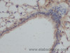 Immunohistochemistry of paraffin-embedded Mouse lung using SERPINE1 Polyclonal Antibody at dilution of 1:50