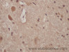 Immunohistochemistry of paraffin-embedded Mouse brain using CD274 Polyclonal Antibody at dilution of 1:50