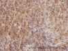Immunohistochemistry of paraffin-embedded Rat spleen using CD3E Polyclonal Antibody at dilution of 1:50
