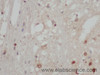 Immunohistochemistry of paraffin-embedded Rat brain using STAT2 Polyclonal Antibody at dilution of 1:50