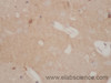 Immunohistochemistry of paraffin-embedded Rat brain using CORO1A Polyclonal Antibody at dilution of 1:50