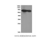 Western Blot analysis of HepG-2 cells and Mouse kidney tissue using IgA Polyclonal Antibody at dilution of 1:600