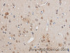Immunohistochemistry of paraffin-embedded Rat brain using EGR2 Polyclonal Antibody at dilution of 1:50