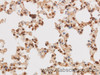 Immunohistochemistry of paraffin-embedded Rat lung using STOM Polyclonal Antibody at dilution of 1:50
