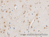 Immunohistochemistry of paraffin-embedded Mouse brain using THRAP3 Polyclonal Antibody at dilution of 1:50