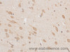 Immunohistochemistry of paraffin-embedded Rat brain using EIF5A2 Polyclonal Antibody at dilution of 1:50