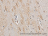 Immunohistochemistry of paraffin-embedded Mouse brain using MAP2 Polyclonal Antibody at dilution of 1:50