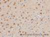 Immunohistochemistry of paraffin-embedded Mouse brain using MAP2K6 Polyclonal Antibody at dilution of 1:50