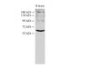 Western Blot analysis of Rat brain tissue using BMPR2 Polyclonal Antibody at dilution of 1:500