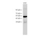 Western Blot analysis of k562 cell using CK-18 Polyclonal Antibody at dilution of 1:500