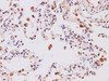 Immunohistochemistry of paraffin-embedded Human lung using IL27 Polyclonal Antibody at dilution of 1:200