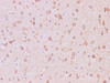 Immunohistochemistry of paraffin-embedded Rat brain using JNK2 Polyclonal Antibody at dilution of 1:200