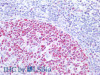 Immunohistochemistry of paraffin-embedded Human tonsil using MCM3 Polyclonal Antibody at dilution of 1:200(Elabscience® Product Detected by Lifespan).