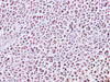 Immunohistochemistry of paraffin-embedded Human lymph node using MCM7 Polyclonal Antibody at dilution of 1:200